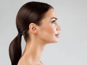 Paciente femenina después de una rinoplastia