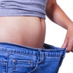 Paciente femenina después de recibir el procedimiento de liposuccion y rebajar peso