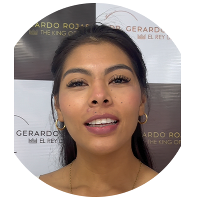 Mamoplastia testimonio